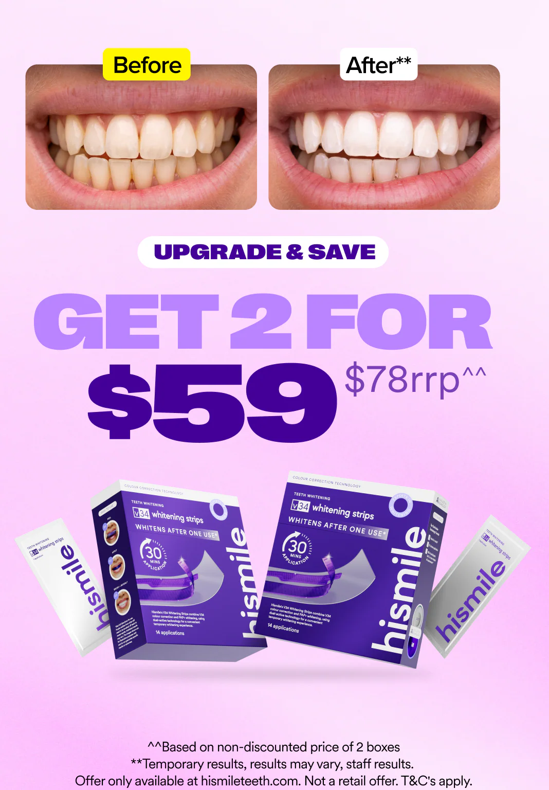 V34 Whitening Strips - Value 2 Pack - Image 3